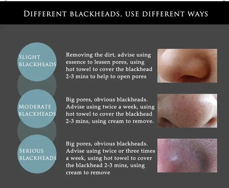 BIOAQUA Activated Carbon Blackhead Removal Peel-Off Mask — 4