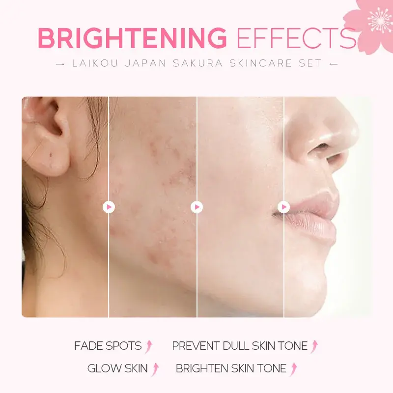 LAIKOU Japan Sakura Skincare Set (5 Pcs Gift Box) — 3